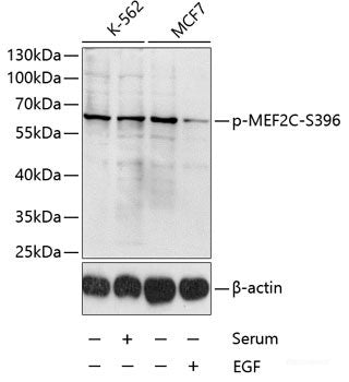 Western blot analysis of extracts of 293T cells using Phospho-PKCalpha(S319) Polyclonal Antibody.