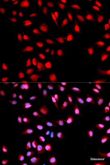 Immunohistochemistry of paraffin-embedded Mouse heart using Phospho-P70 S6K(T389) Polyclonal Antibody at dilution of 1:100 (40x lens).