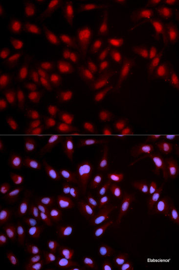 Western blot analysis of extracts of HeLa cells using Phospho-CHEK2(T68) Polyclonal Antibody.