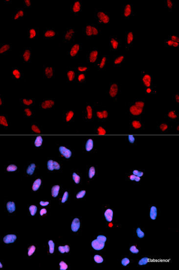 Western blot analysis of extracts of HCT116 cells using Phospho-IRF3(S396) Polyclonal Antibody at dilution of 1:1000.