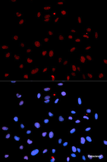 Western blot analysis of extracts of HeLa cells using Phospho-NFKBIA(S32) Polyclonal Antibody at dilution of 1:1000. HeLa cells were treated by TNF-α (20 ng/ml) at 37°C for 30 minutes.
