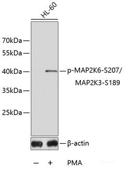 Western blot analysis of extracts of HeLa cells using Phospho-eIF2α(S51) Polyclonal Antibody at dilution of 1:2000.