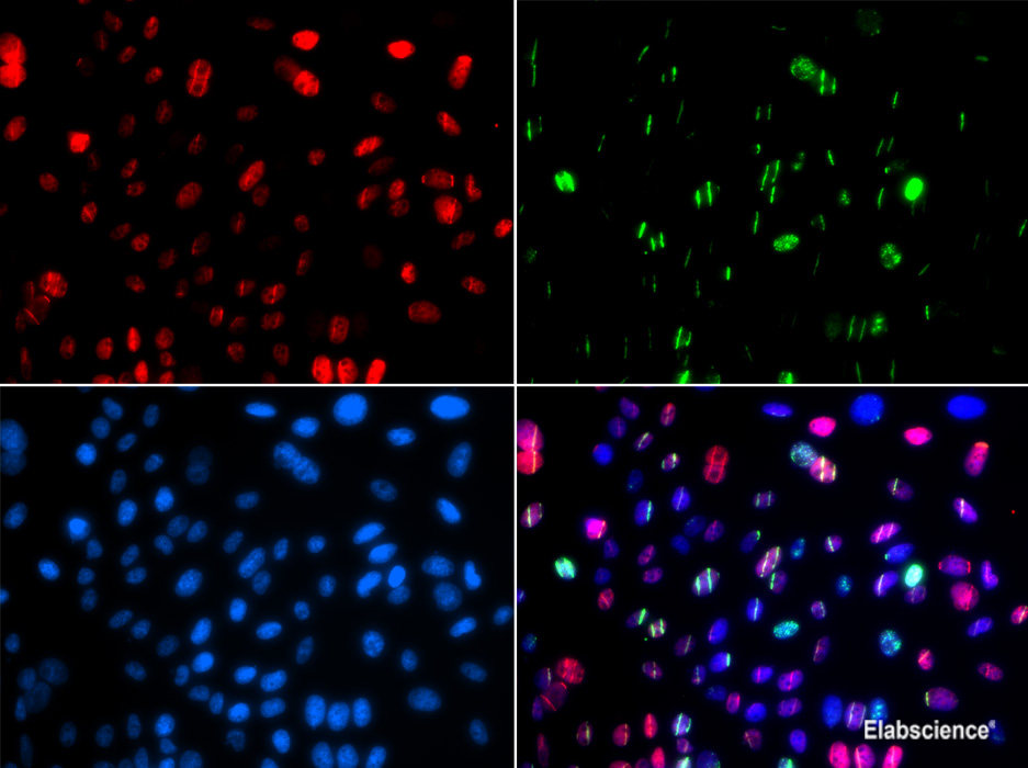 Western blot analysis of extracts of MCF7 cells using Phospho-POLR2A(S5) Polyclonal Antibody at dilution of 1:1000. MCF7 cell lysate were treated by CIP (20ul CIP for each 400ul cell lysate) at 37°C for 1 hour.