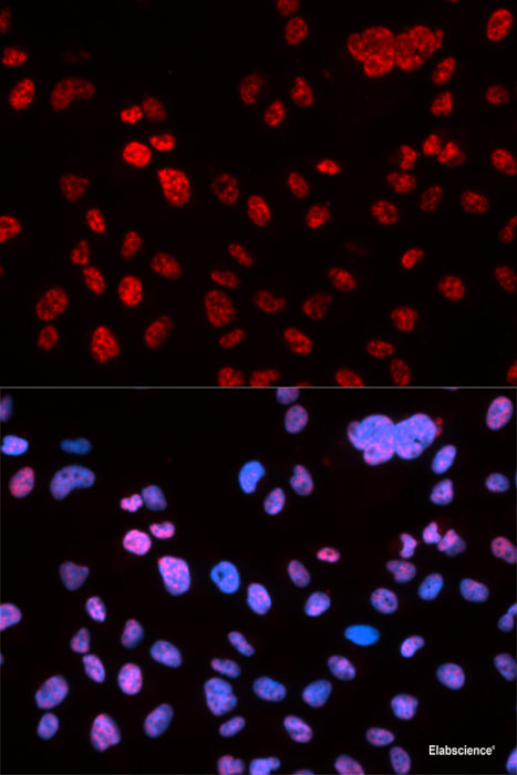 Western blot analysis of extracts of HeLa cells using Phospho-Histone H3(S10) Polyclonal Antibody at dilution of 1:1000. HeLa cells were treated by Calyculin A (100 nM) at 37°C for 30 minutes after serum-starvation overnight.