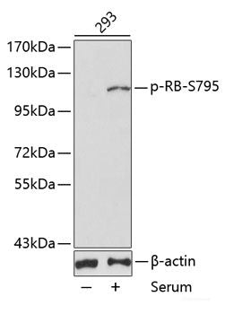 Immunohistochemistry of paraffin-embedded Rat lung using Phospho-PEA15(S104) Polyclonal Antibody at dilution of 1:100 (40x lens).
