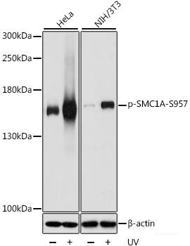 Immunohistochemistry of paraffin-embedded Human appendix using Phospho-PLN(T17) Polyclonal Antibody at dilution of 1:100 (40x lens).