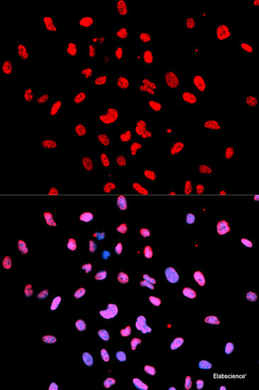 Western blot analysis of extracts of 293T cells using Phospho-p53(S15) Polyclonal Antibody at dilution of 1:1000. 293T cells were treated by UV at room tempeRature for 15-30 minutes.