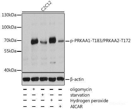 Western blot analysis of extracts of 293T cells using Phospho-P70S6K1(T389) Polyclonal Antibody at dilution of 1:1000. 293T cells were treated by IGF-1 (50 ng/ml) at 37°C for 5 minutes after serum-starvation overnight. 293T cells were treated by 10% FBS at 37°C for 30 minutes after serum-starvation overnight.