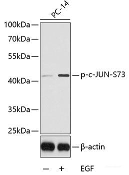 Immunohistochemistry of paraffin-embedded Rat kidney using Phospho-ABL1(Y412) Polyclonal Antibody at dilution of 1:100 (40x lens).