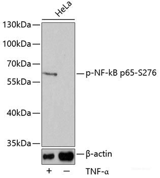 Immunohistochemistry of paraffin-embedded Rat liver using Phospho-Histone H2A(S129) Polyclonal Antibody at dilution of 1:100 (40x lens).