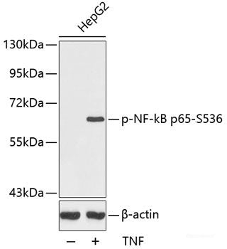 Western Blot analysis of various samples using ITGAX Polyclonal Antibody at dilution of 1:1000.