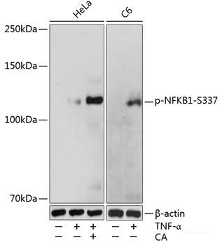 Immunohistochemistry analysis of paraffin-embedded human orchidoncus using Cyclin E1 Polyclonal Antibody at dilution of 1:400.