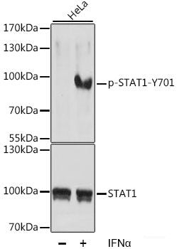 Immunohistochemistry analysis of paraffin-embedded human Tonsil using AIFM1 Polyclonal Antibody at dilution of 1:400.