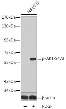 Western Blot analysis of various samples using Catenin beta Polyclonal Antibody at dilution of 1:1000.