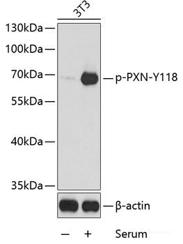 Western Blot analysis of various samples using c-Fos Monoclonal Antibody at dilution of 1:1000.