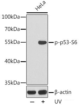 Western Blot analysis of various samples using CDC25A Polyclonal Antibody at dilution of 1:1000.