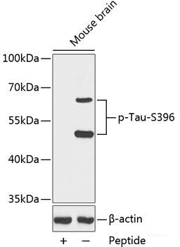 Western Blot analysis of various samples using IL17RA Polyclonal Antibody at dilution of 1:1000.