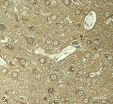 Immunohistochemistry analysis of paraffin-embedded mouse bone using TNFRSF11B Polyclonal Antibody at dilution of 1:200.