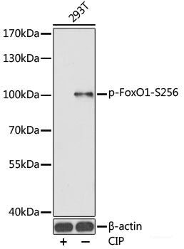 Western Blot analysis of various samples using RAGE Polyclonal Antibody at dilution of 1:750.
