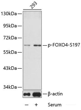 Immunohistochemistry analysis of paraffin-embedded mouse brain using DCX Polyclonal Antibody at dilution of 1:400.