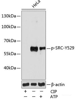 Immunohistochemistry analysis of paraffin-embedded rat lungs using MMP9 Polyclonal Antibody at dilution of 1:300.