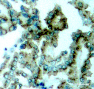 Immunohistochemistry analysis of paraffin-embedded human colon using MUC2 Polyclonal Antibody at dilution of 1:600.