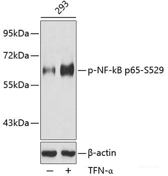 Western Blot analysis of various samples using ACHE Polyclonal Antibody at dilution of 1:750.