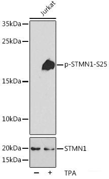 Western Blot analysis of various samples using TGF β Receptor I Polyclonal Antibody at dilution of 1:750.