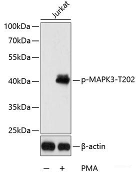 Western Blot analysis of various samples using NOX4 Polyclonal Antibody at dilution of 1:1000.