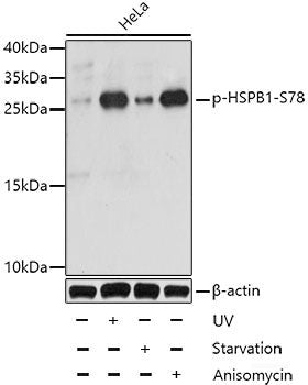Western Blot analysis of various samples using CAV1 Polyclonal Antibody at dilution of 1:800.