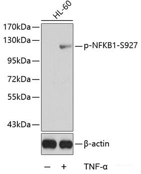 Western Blot analysis of various samples using CD284 Polyclonal Antibody at dilution of 1:1000.