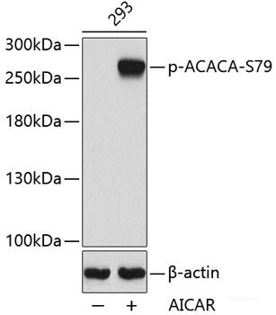 Immunohistochemistry analysis of paraffin-embedded mouse spleen using SOCS1 Polyclonal Antibody at dilution of 1:300.