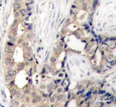 Immunohistochemistry analysis of paraffin-embedded rat lymph node using BAG2 Polyclonal Antibody at dilution of 1:400.