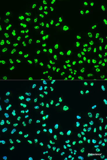 Western Blot analysis of various samples using STAT1 Polyclonal Antibody at dilution of 1:1000.