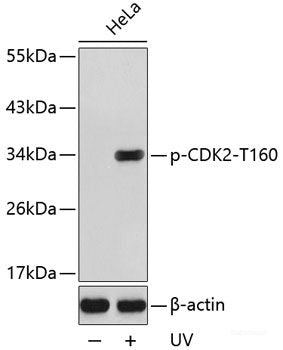 Western Blot analysis of various samples using COX2 Polyclonal Antibody at dilution of 1:1000.