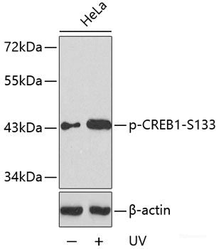 Immunohistochemistry analysis of paraffin-embedded mouse bone using BGLAP Polyclonal Antibody at dilution of 1:100.