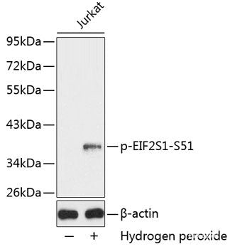 Immunohistochemistry analysis of paraffin-embedded human Prostate using AR Polyclonal Antibody at dilution of 1:300.