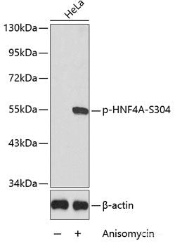 Western Blot analysis of various samples using ATF2 Polyclonal Antibody at dilution of 1:600.