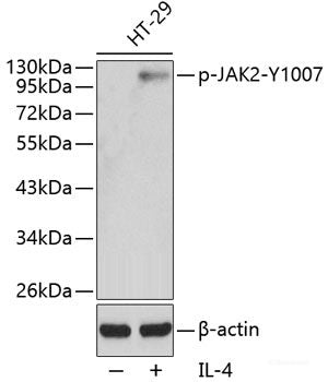 Western Blot analysis of various samples using TAGLN Polyclonal Antibody at dilution of 1:600.