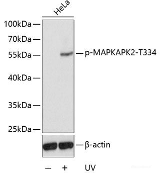 Immunohistochemistry analysis of paraffin-embedded mouse Immunized spleen using S100A8 Polyclonal Antibody at dilution of 1:400.