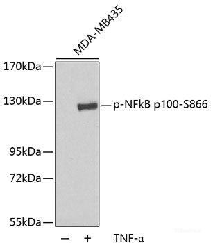Immunohistochemistry analysis of paraffin-embedded mouse inflammatory spleen using IL2 Polyclonal Antibody at dilution of 1:500.
