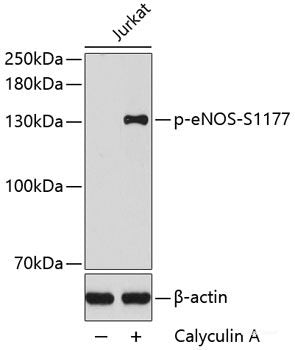 Western Blot analysis of various samples using FSHR Polyclonal Antibody at dilution of 1:750.