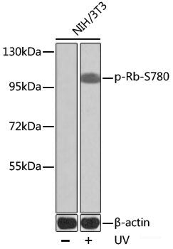 Immunohistochemistry analysis of paraffin-embedded Rat skeletal muscle using CD31 Monoclonal Antibody at dilution of 1:200.