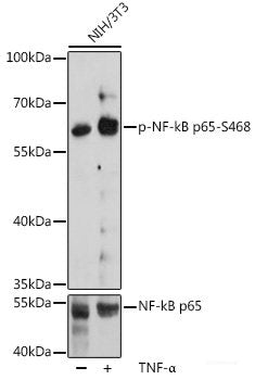 Immunohistochemistry analysis of paraffin-embedded human colon cancer using JMJD6 Polyclonal Antibody at dilution of 1:1000.