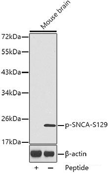 Western Blot analysis of various samples using S100A4 Polyclonal Antibody at dilution of 1:600.