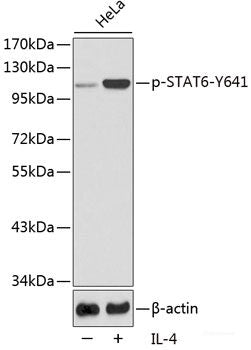 Immunohistochemistry analysis of paraffin-embedded human colon using Claudin 5 Polyclonal Antibody at dilution of 1:400.