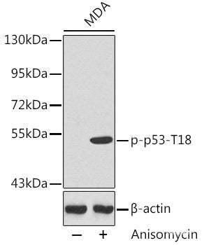 Immunohistochemistry analysis of paraffin-embedded mouse kidney using BRAF Polyclonal Antibody at dilution of 1:400.