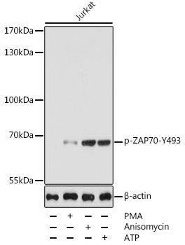 Western Blot analysis of various samples using GABAA Receptor alpha1 Polyclonal Antibody at dilution of 1:1000.