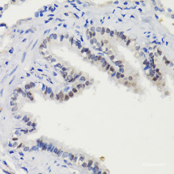 Immunohistochemistry analysis of paraffin-embedded Human tonsil using p21 Polyclonal Antibody at dilution of 1:300.