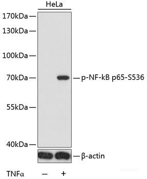 Western Blot analysis of various samples using DLL3 Polyclonal Antibody at dilution of 1:1000.